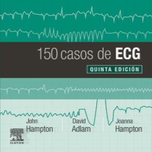 150 CASOS DE ECG  5ª ED,