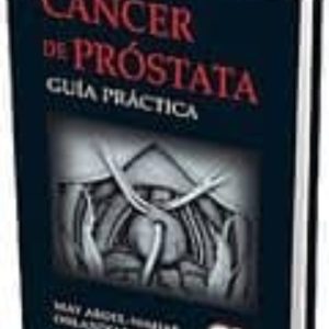CANCER DE PROSTATA. GUIA PRACTICA