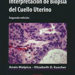 INTERPRETACION DE BIOPSIA DEL CUELLO UTERINO (2ª ED.)