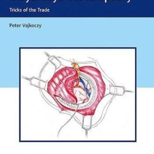 SURGICAL TECHNIQUES IN MOYAMOYA VASCULOPATHY. TRICKS OF THE TRADE
				 (edición en inglés)