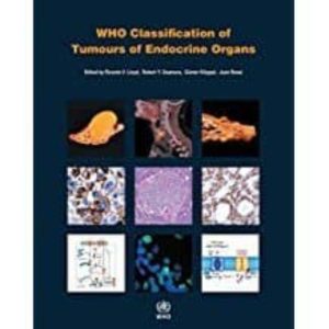 WHO CLASSIFICATION OF TUMOURS OF ENDOCRINE ORGANS (4TH ED)
				 (edición en inglés)