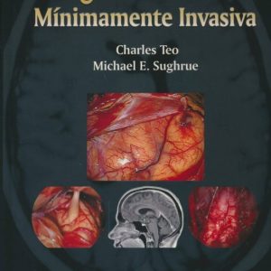 CIRUGIA DEL CEREBRO MINIMAMENTE INVASIVA + DVD