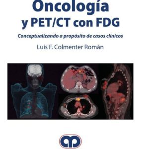 ONCOLOGÍA Y PET/CT CON FDG