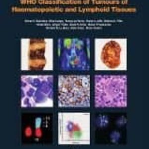 WHO CLASSIFICATION OF TUMOURS OF HAEMATOPOIETIC AND LYMPHOID TISSUES : VOL. 2 : 2 (4TH ED REV)
				 (edición en inglés)